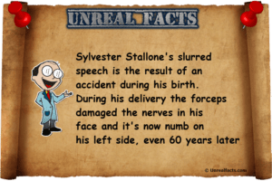 sylvester-stallone-slurred-speech-impediment